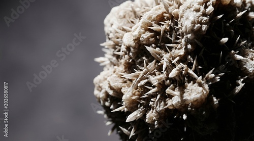 A close-up image shows the sharp, pointed details of a calcium oxalate kidney stone against a dark background.