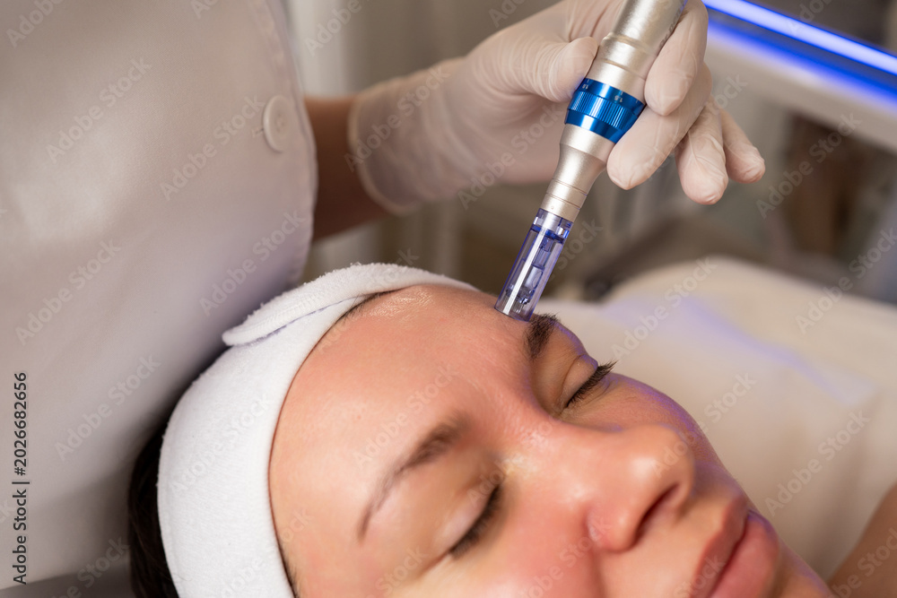 Φωτογραφία Woman receiving microneedling treatment on her face for skin rejuvenation in a b