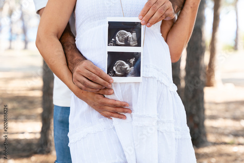 Pregnant couple holding ultrasound photo close to belly with love. Expecting parents showing tenderness, joy and emotional connection,representing family, anticipation and new life in natural daylight
