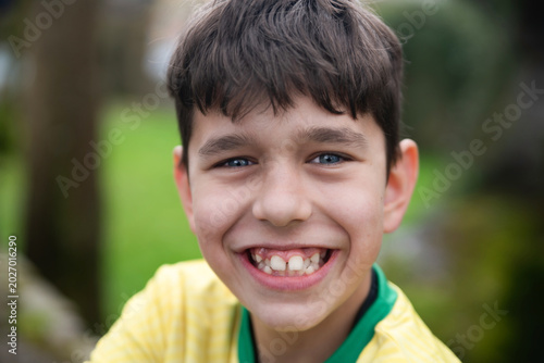 A cute young boy is walking invpark, happy, smiling beautifully, his teeth are white but crooked, he needs braces, teeth alignment, missing front tooth