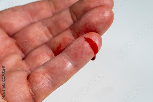 Obraz na płótnie Bleeding cut injury on finger tip, close up