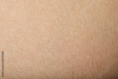Fényképezés Texture of normal skin as background, closeup