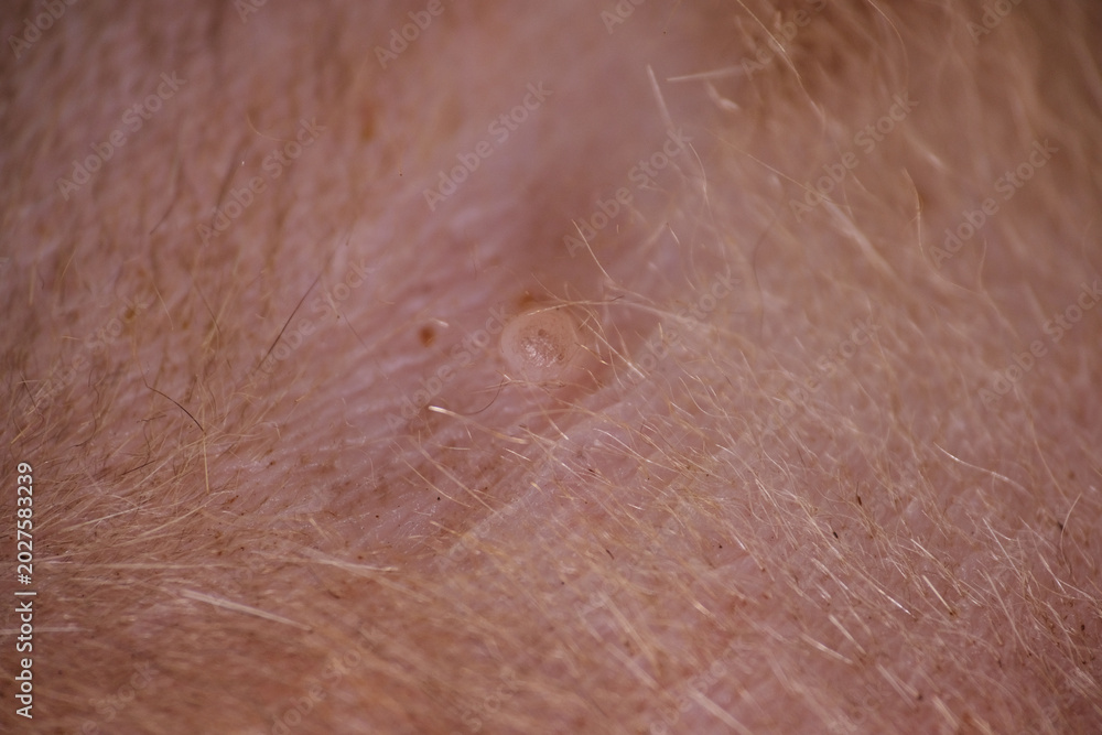 Fototapeta premium Shaving cat fur before apply antiseptic on wound
