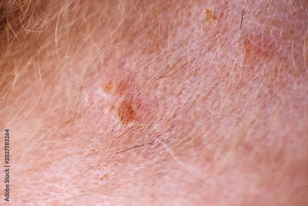 Fototapeta premium Shaving cat fur before apply antiseptic on wound