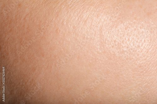 Φωτογραφία Texture of normal skin as background, closeup