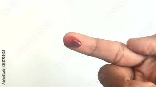 Red blood dripping from a fingertip on a white background. Suitable for medical concepts, first aid, injuries, laboratory tests, or blood donations