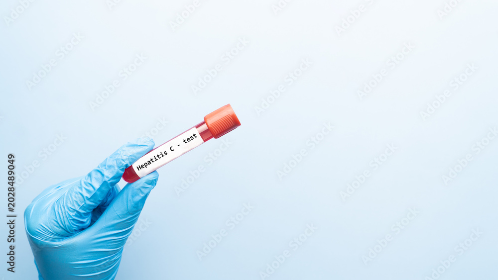 Obraz premium Blood sample tube with hepatitis C test label on medical laboratory technologist hands over blue background.