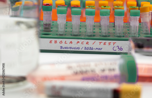 Several vials being prepared for testing in connection with a new Ebola virus in the DRC’s Ituri province, strain bundibugyo, in the east of the country, in a laboratory, studio reconstruction