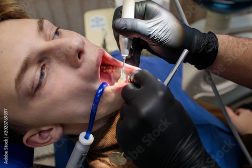 Fotografija close up of dentist in black gloves using ultrasonic scaler with spray near teen
