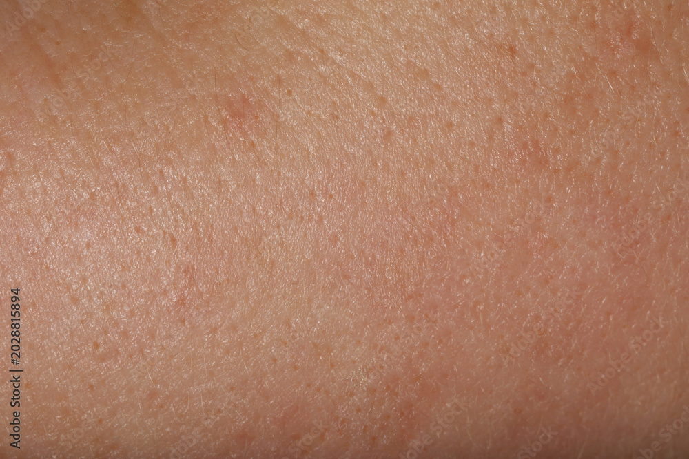 Fototapeta premium Texture of normal skin as background, closeup