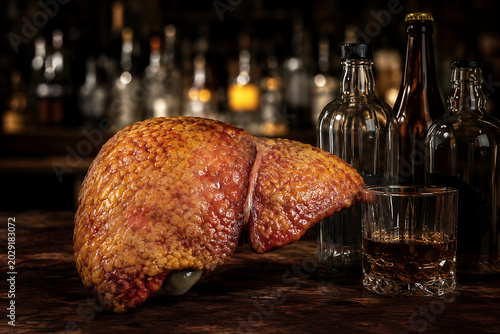 Alcohol-Related Fatty Liver Disease