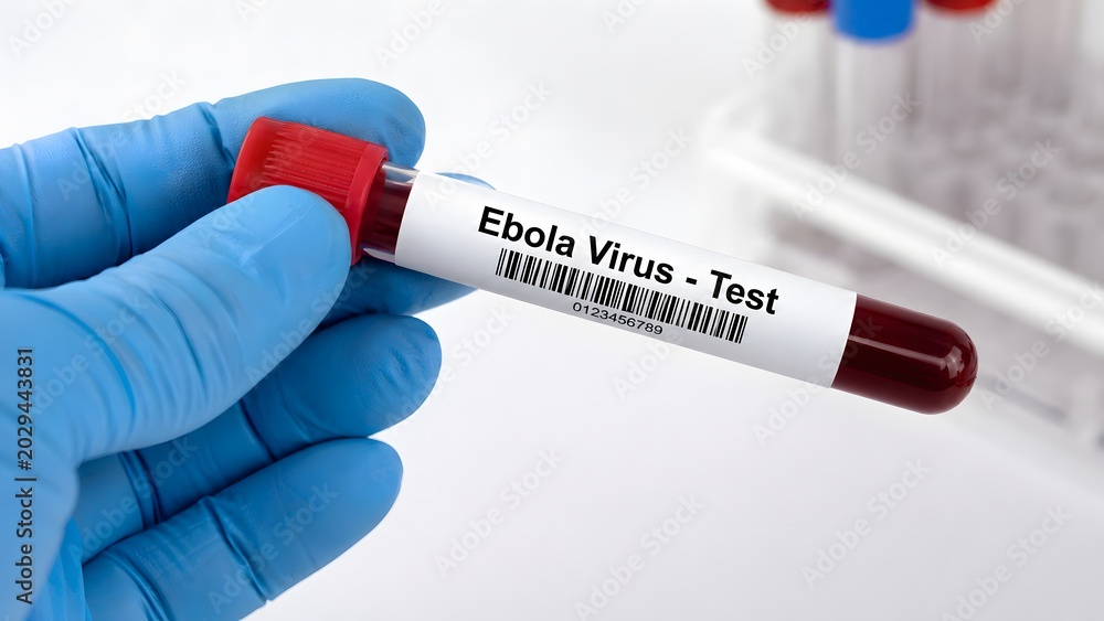 Obraz premium Ebola virus blood test sample with gloved hand medical laboratory diagnosis infectious disease outbreak and healthcare research concept