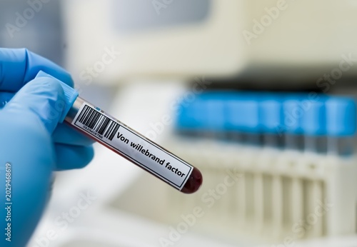 Foto Blood sample tube for von wlillebrand factor test analysis.
