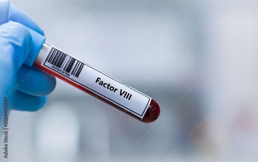 Fototapeta premium Blood sample tube for factor VIII test analysis.