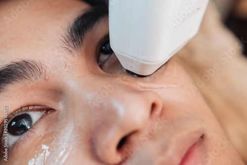Closeup of a young handsome male client receiving 2D HIFU treatment on the cheek and under eye area for skin tightening.