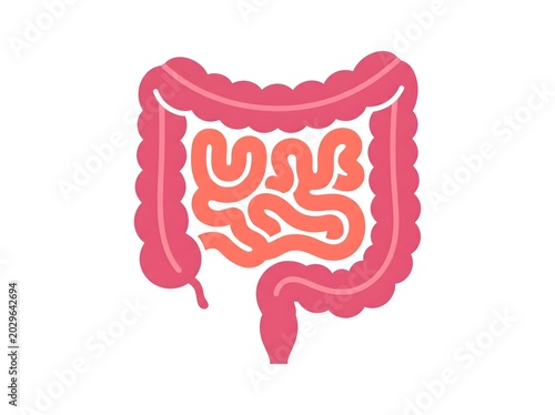 Simplified anatomical illustration of the human digestive system showing the large and small intestines in a medical context.