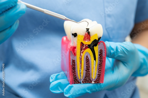 Konstfotografi Dentist holding dental implant, artificial tooth roots into jaw, root canal of dental treatment, gum disease, teeth model for dentist