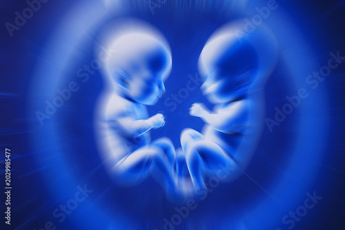 embryo twins