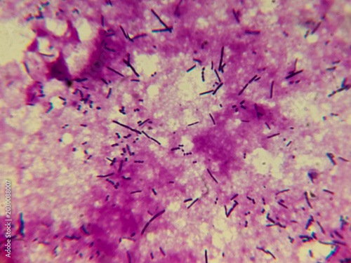 Photos Lactobacillus Gram-Stained Bacteria Rods Under Microscope