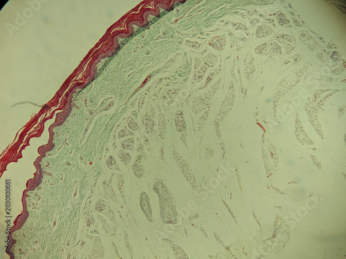 Foto Keratinized Epithelial Gland Duct Cross Section Masson Trichrome Stain Micro