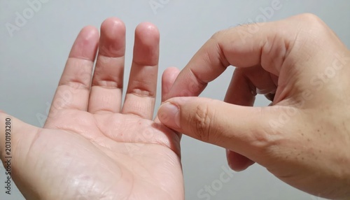 A Person Holding A Small Piece Of Skin