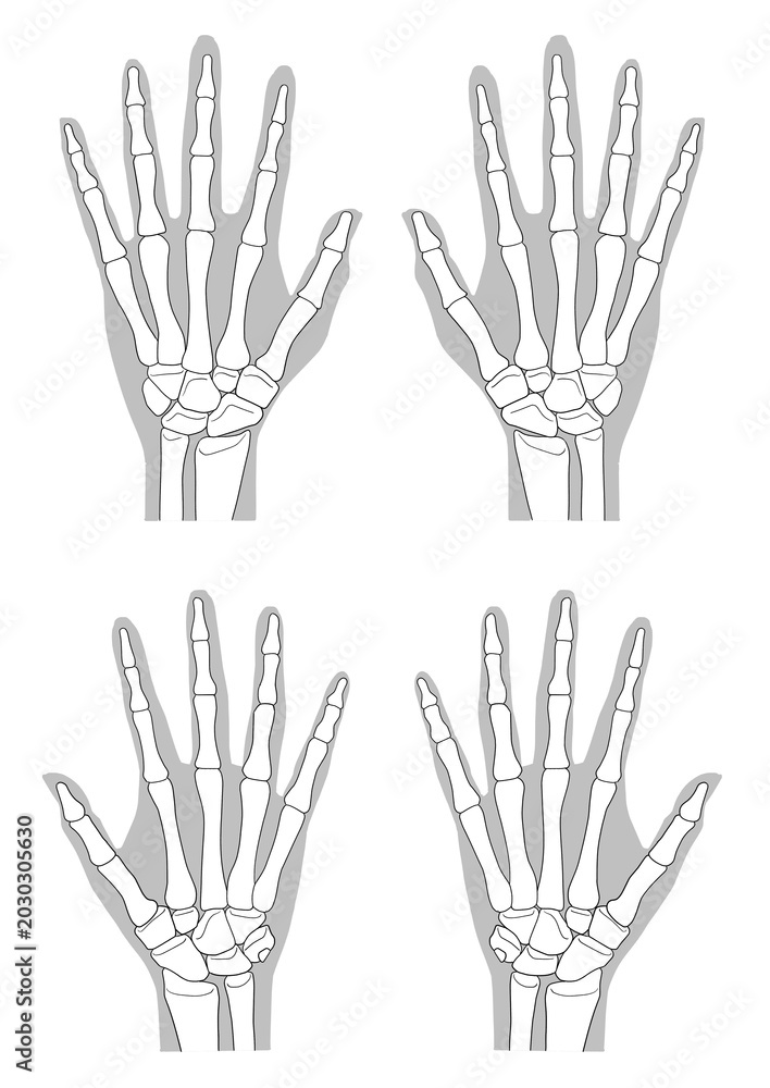 Ταπετσαρία Human hand bone anatomy, (anterior and posterior view)