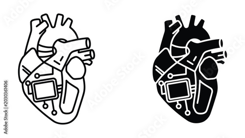 Obraz na płótnie Pacemaker implanted in human heart illustration
