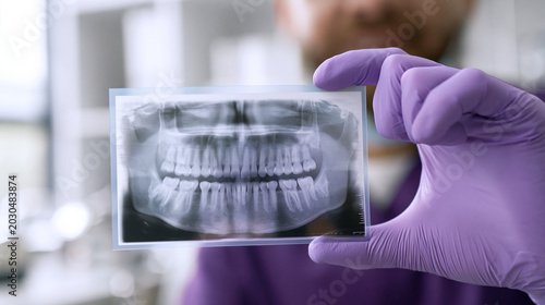 A dentist holding an x-ray of teeth in a medical setting with purple gloves
