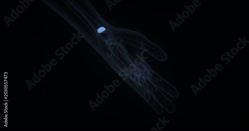 Pronator quadratus muscle in human body. X Ray. Loop