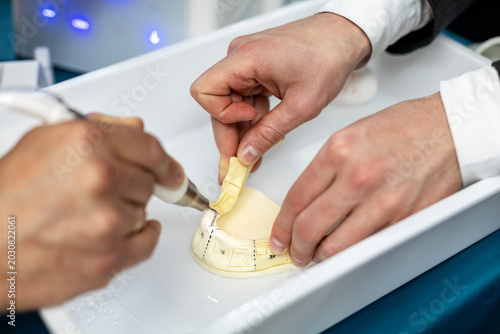 Tableau sur toile Hands Practicing Dental Scaling on Model
