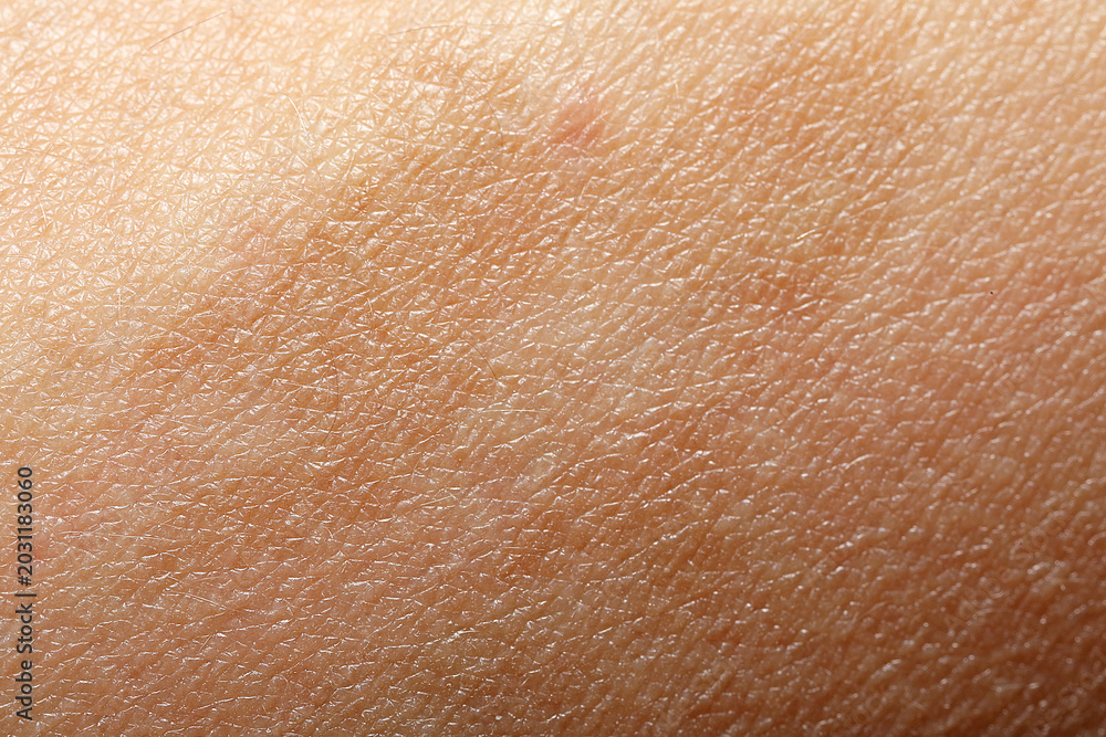 Fototapeta premium Macro view of skin with birthmark as background