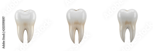 Tableau sur toile Set of White Human Molar Tooth Anatomy Models Dental Healthcare Concept PNG Oil