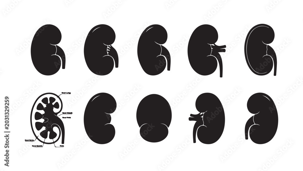 Fototapeta premium Medical illustrations of human kidney anatomy and conditions variety