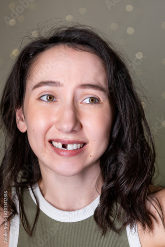 Canvastavla Mature Caucasian woman expressing emotions after losing a front tooth during den