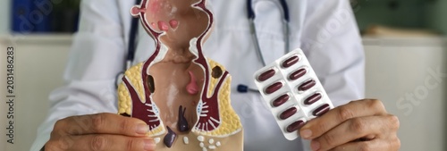 Doctor explains treatment options using anatomical model and medication