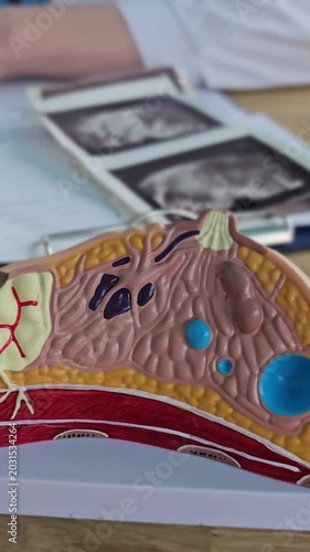 Anatomy of the mammary gland and mammary glands. Oncological treatment