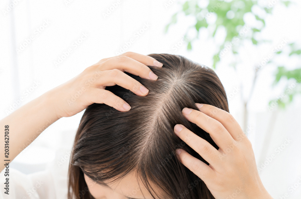 Naklejka premium 女性 薄毛