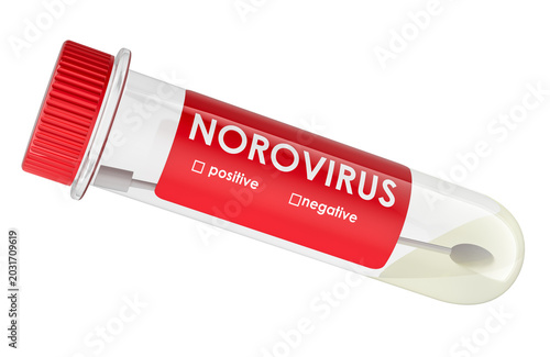 Tableau sur toile Norovirus test tube with swab sample. 3d rendering