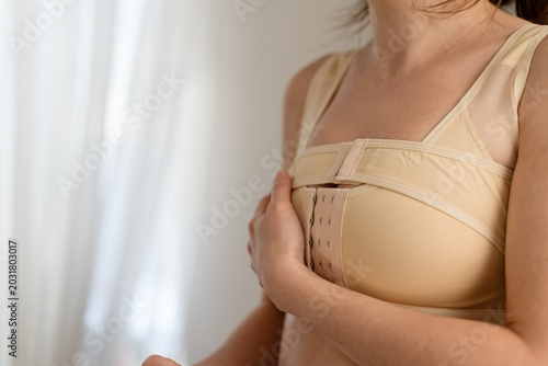 A woman focuses on reducing swelling after breast reconstruction by wearing a postoperative compression bra. Edema management.