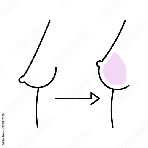 Breast augmentation icon. Healthcare and plastic surgery line symbol. Color.
