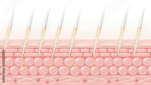 Spicule microneedle serum delivery and transdermal skincare technology illustration