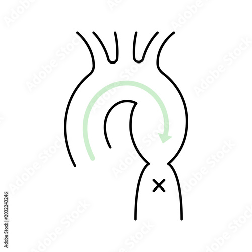 Bild auf Leinwand Aortic coarctation icon