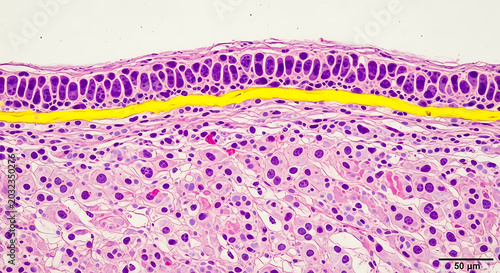 Microscopic image of human skin showing epidermis and dermis layers with highlighted basement membrane