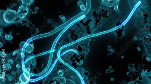 Foto Ebola virus particles under an electron microscope