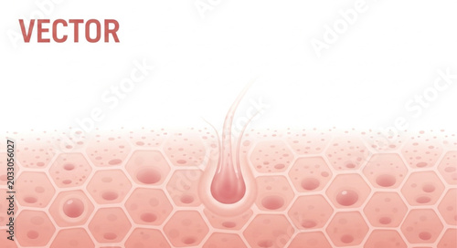 Photos Skin texture with acne lesion closeup.