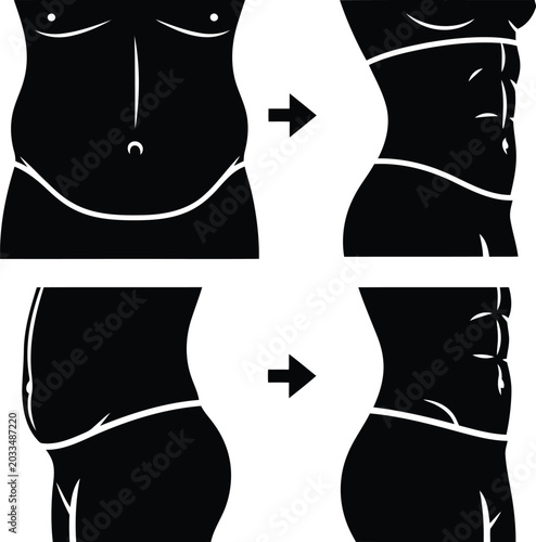 Canvas-taulu Weight Loss Body Transformation Concept with Slimmer Waist and Belly Before and