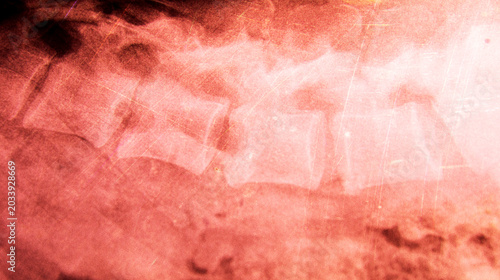 Fotografie Red toned grunge spine x-ray with vertebrae anatomy forming abstract medical background, concept of pain, injury, degeneration and healthcare