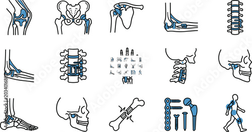 Canvastavla Orthopedic anatomy and implant illustration set showing joints bones and surgica