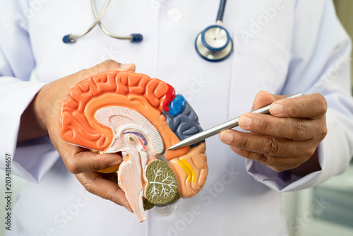 Alzheimer disease, Asian doctor holding brain anatomy model for study diagnosis and treatment in hospital.