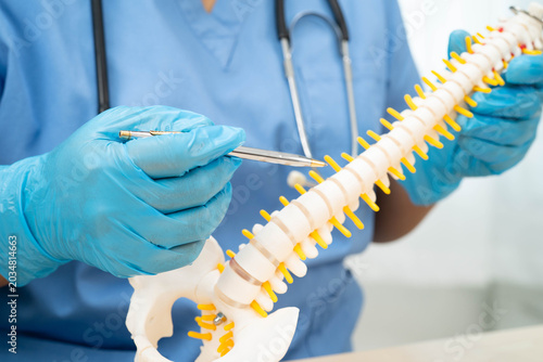 Konstfotografi Asian doctor holding spinal nerve and bone model, Lumbar spine displaced herniated disc fragment for treatment medical in the orthopedic department